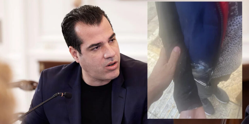 Θάνος Πλεύρης: Στο νοσοκομείο μετά την επίθεση με γιαούρτι στα Πετράλωνα.Τραυματίστηκε… Θάνος-Πλεύρης:-Στο-νοσοκομείο-μετά-την-επίθεση-με-γιαούρτι-στα-Πετράλωνα.Τραυματίστηκε…